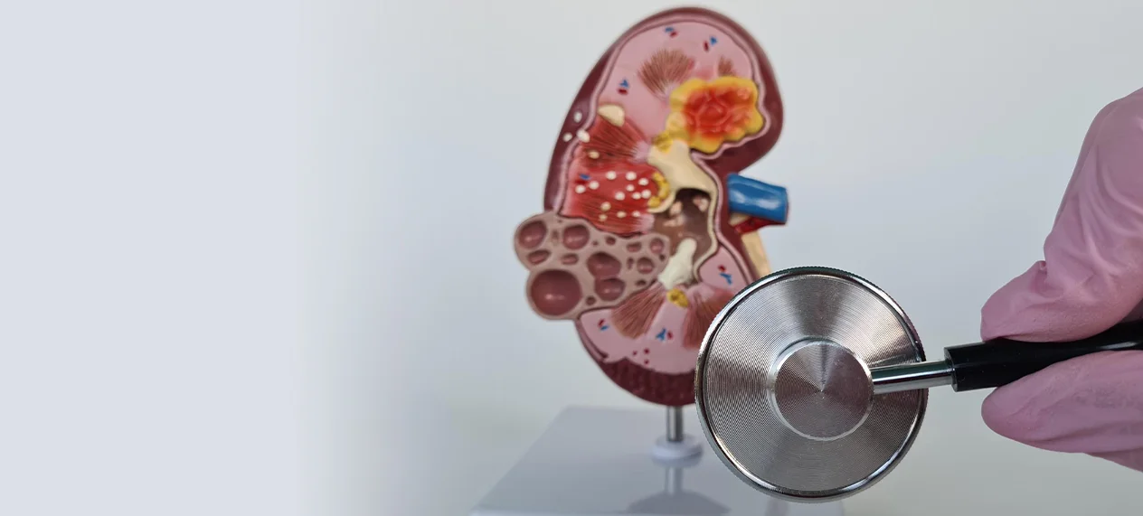 How To Detect Kidney Cancer Early: Key Warning Signs And Tests?
